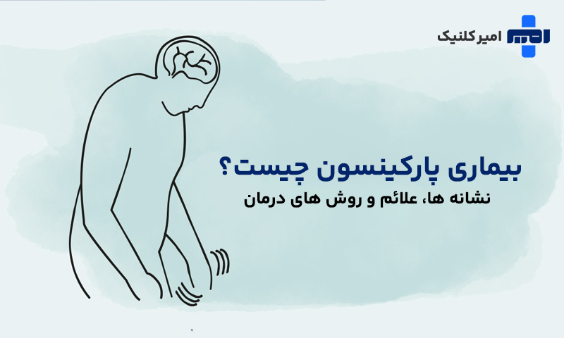 بیماری پارکینسون